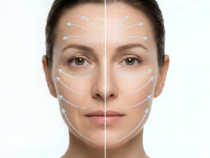 aesthetic looking wrinkle reduction targeted treatments