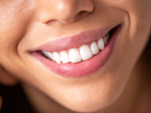 Close up of a beautiful smile with bright white teeth