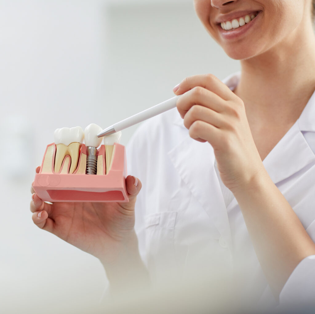 Dentist explaining dental implant crown process to patient