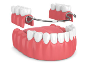 dentistry dentures full partial restore smile