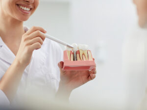 Smiling dentist explaining tooth implantation options
