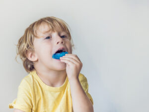 Three-year-old boy demonstrates myofunctional trainer for mouth breathing