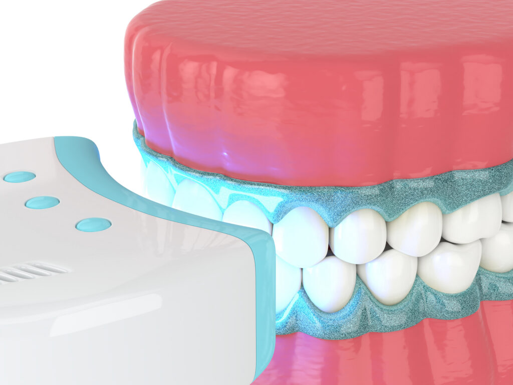 3D illustration of professional teeth whitening process