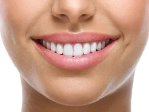 Closeup of a woman smiling with bright white teeth