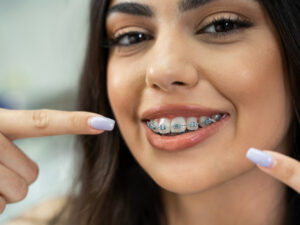 Young woman with dental braces pointing at her mouth